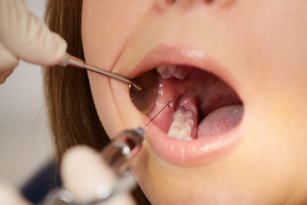 Dentist making anaesthetic injection to woman patient